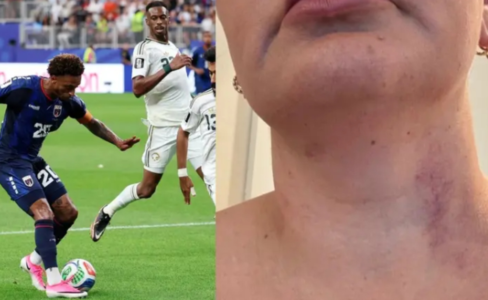 اتهام قائد الرأس الأخضر باغتصاب مترجمة المنتخب في يوم التأهل